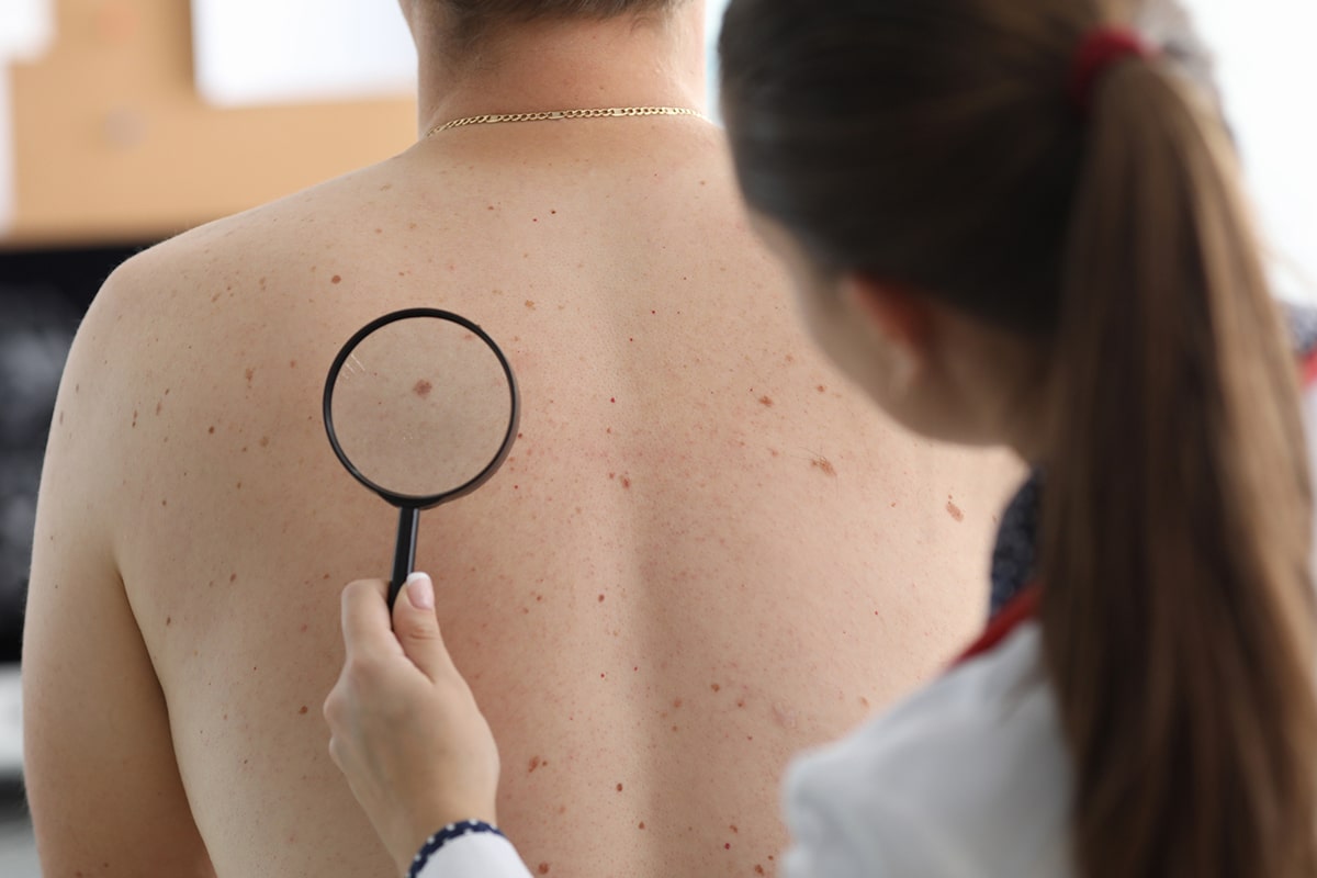 Doctor Looking At Patients Moles On Their Back