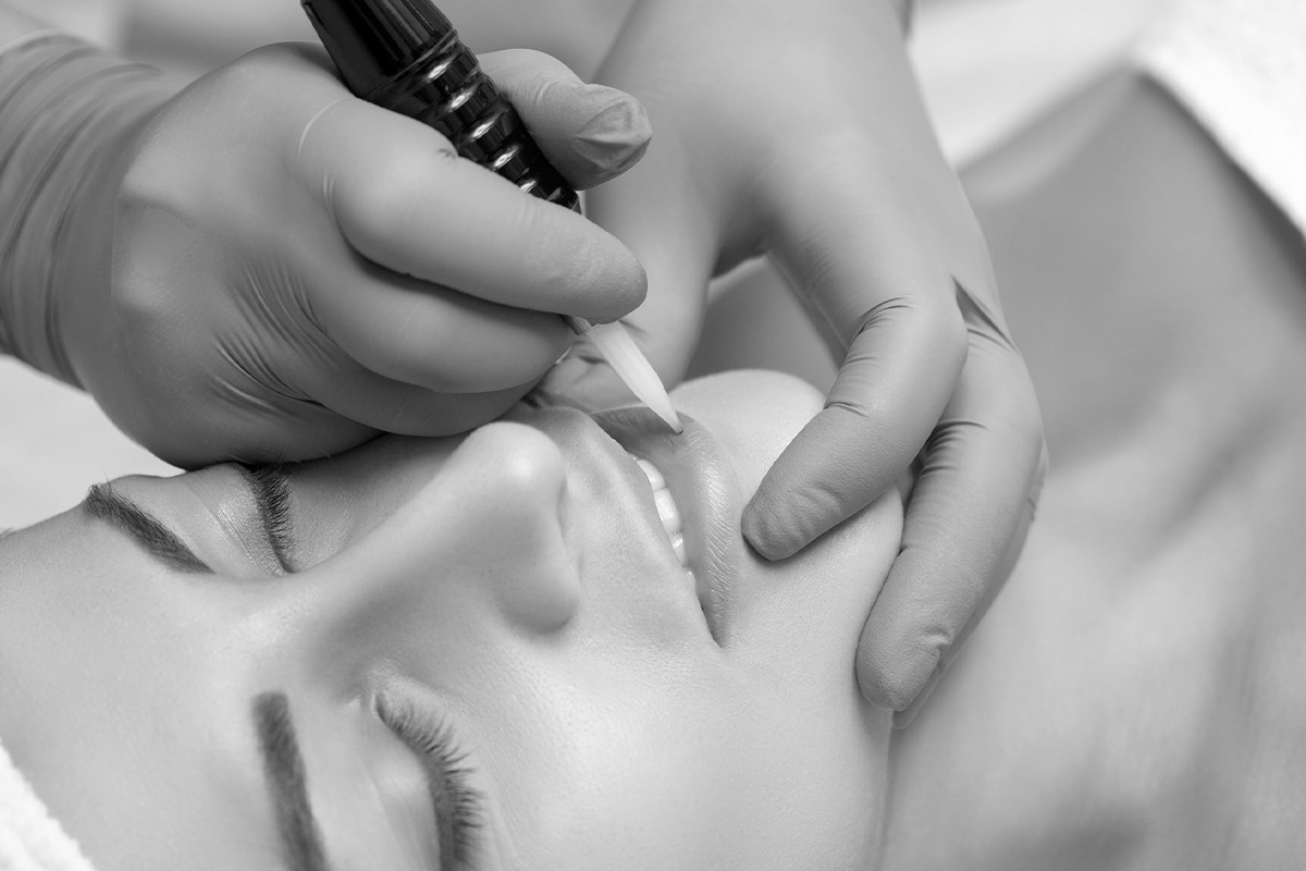 A Woman Getting Permanent Makeup On Her Lower Lip, Black And White Photo